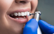 Dental Cleaning Sydney